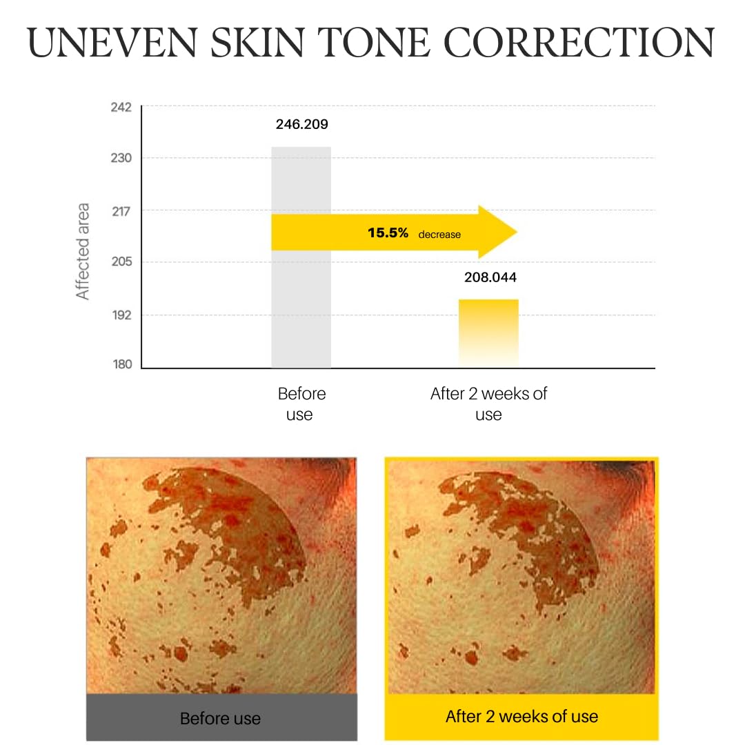 d'alba Piedmont White Truffle Vita Toning Serum Toner, Glass Skin with Double Vitamin Skincare, Face Moisturizer, (6.09 fl. oz) - Maple Wellness Supplements