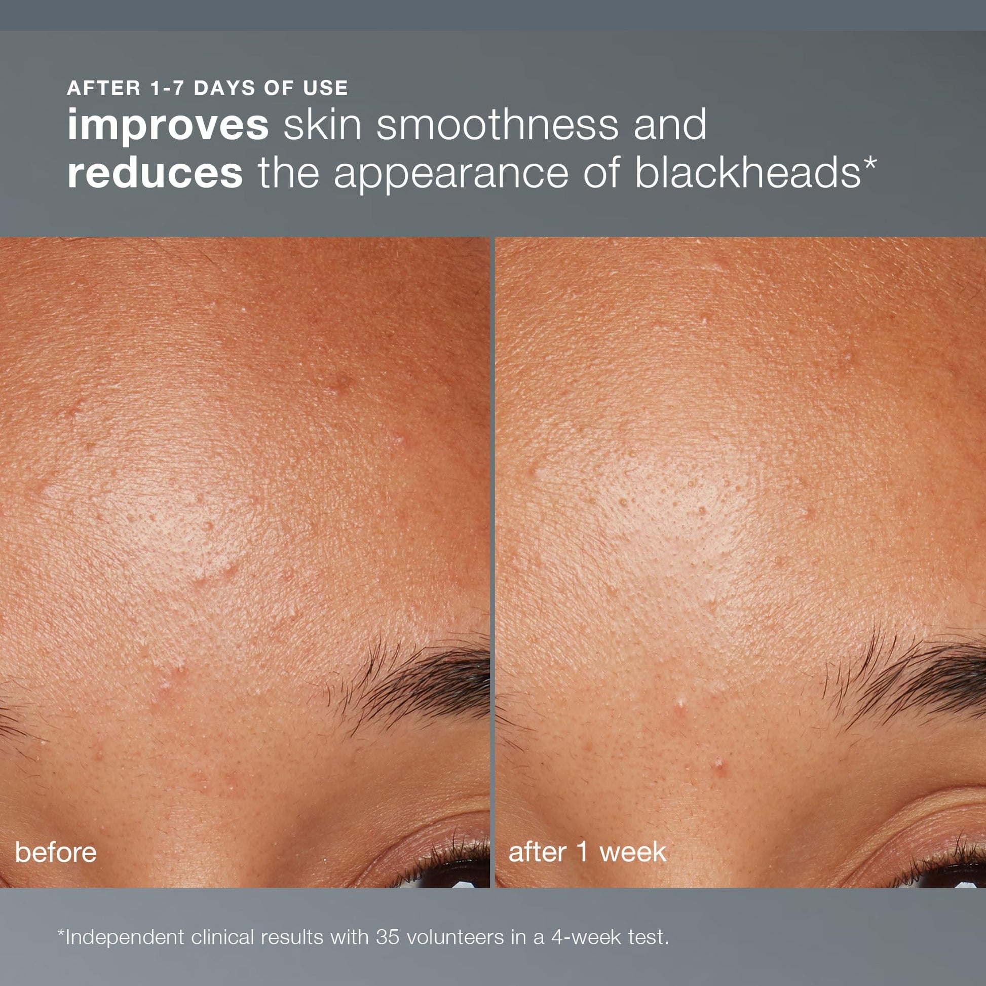 Dermalogica Daily Microfoliant, Face Exfoliator Scrub Powder with Salicylic Acid and Papaya - Maple Wellness Supplements