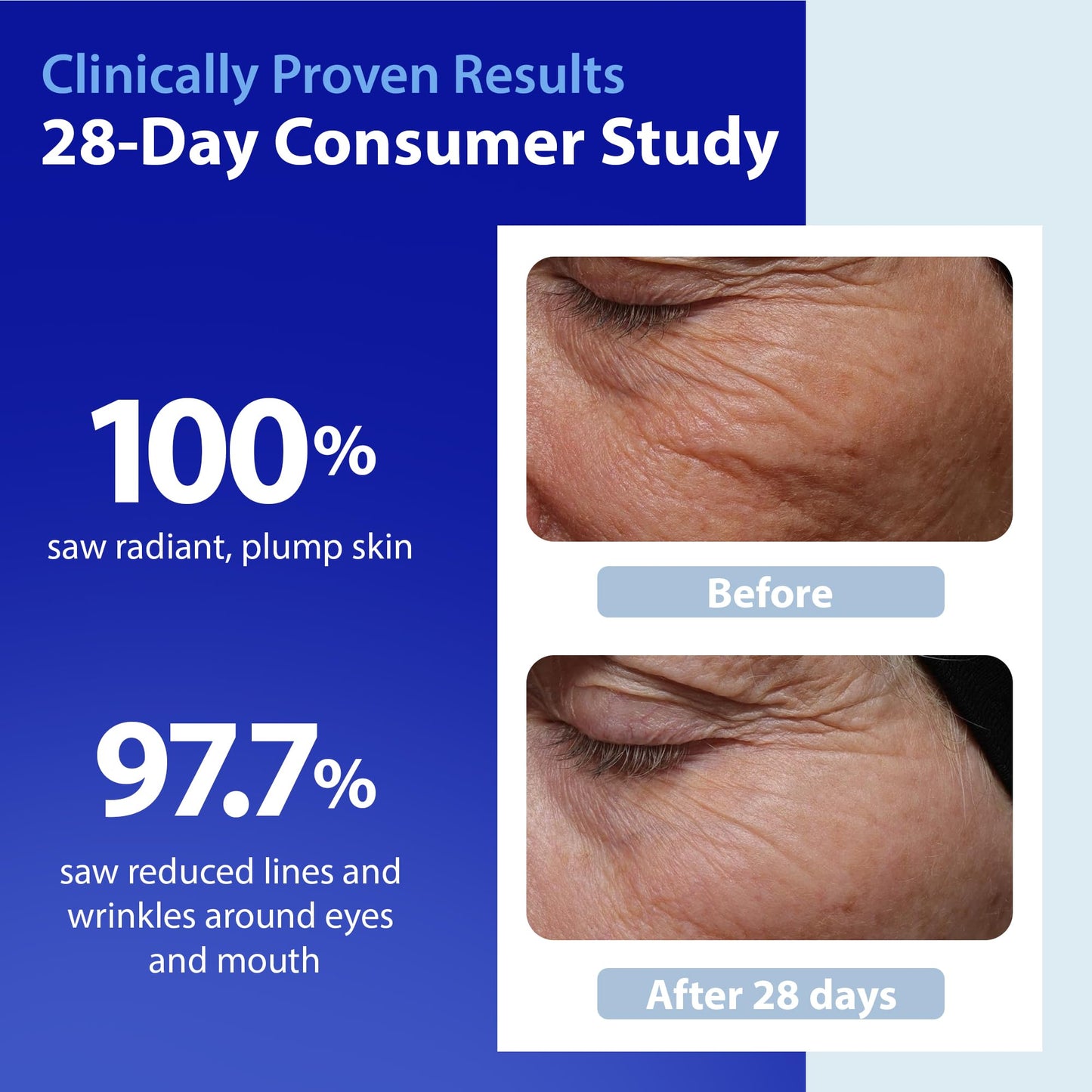 Dr. Denese SkinScience HydroShield Retinol Serum for Face 4 oz – Dermatologist Tested Hydrating Serum, Contains Retinol and Ceramides for Deep Moisture - Cruelty Free - Maple Wellness Supplements