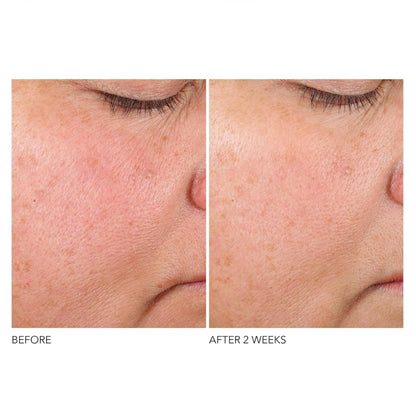 Dr. Dennis Gross Advanced Retinol + Ferulic Texture Renewal Serum – Anti-Aging Formula to Smooth Texture, Boost Radiance, and Minimize Fine Lines & Wrinkles, 1 oz - Maple Wellness Supplements
