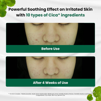 Dr. G R.E.D. Blemish Clear Soothing Cream - Calming Korean Moisturizer for Redness - Soothes Acne & Irritation - Maple Wellness Supplements