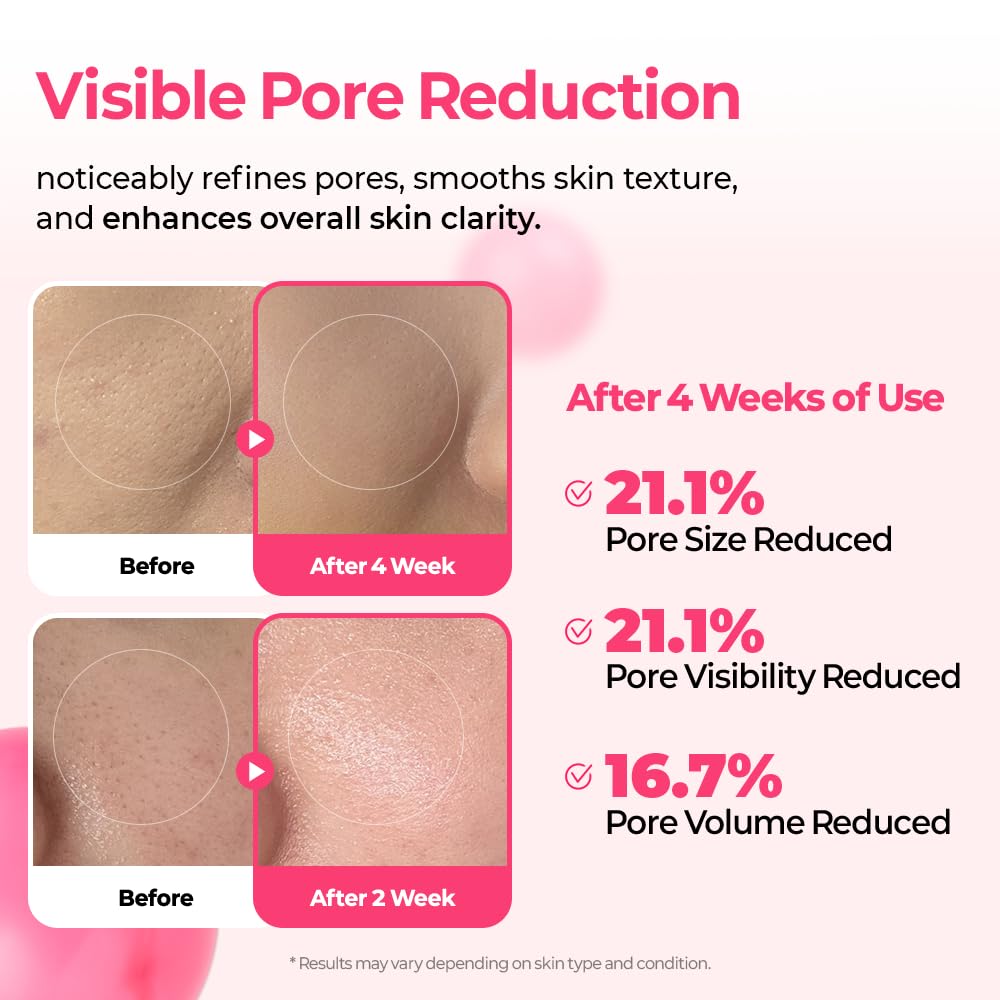 Dr.Melaxin Cyano Pink Spicule Niacinamide Serum – Vitamin B12 Pore Minimizer, Liquid Microneedle Facial Treatment - Maple Wellness Supplements