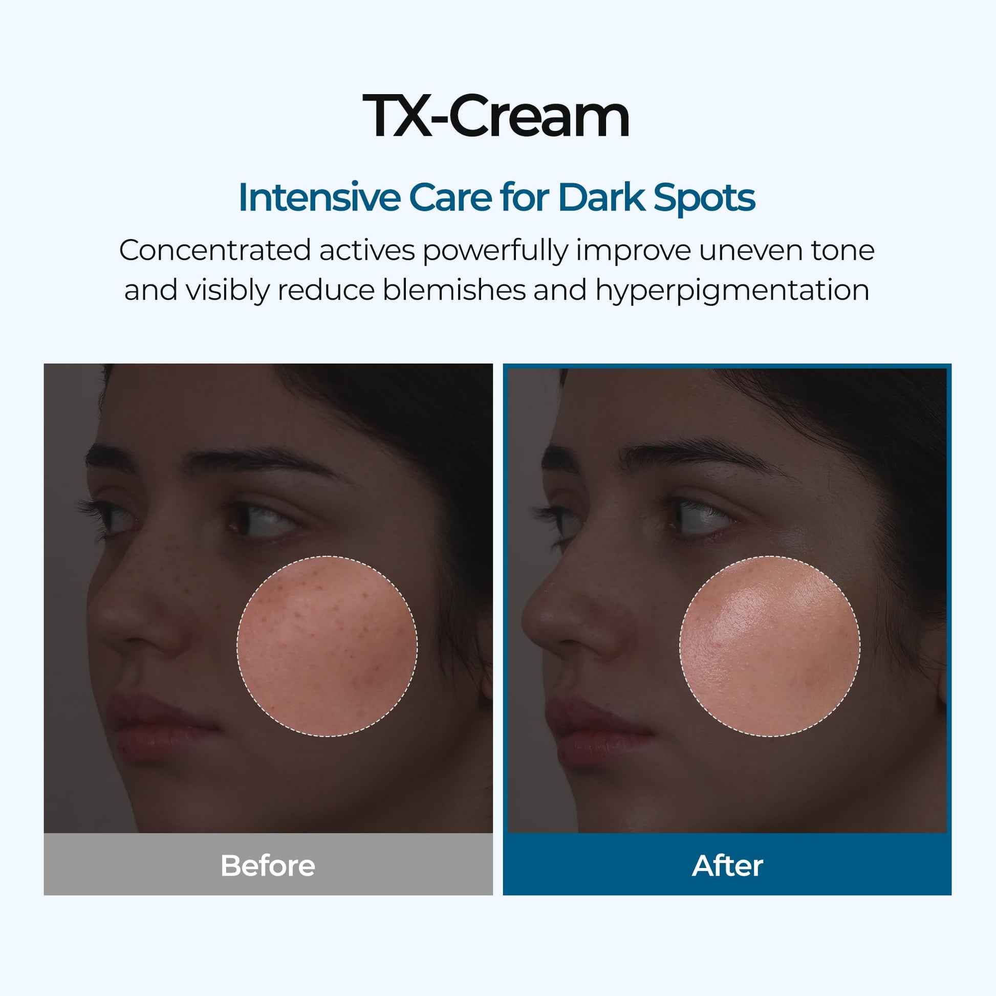 DR.Melaxin TX Tranexamic Acid CREAM | Skin freckle Cream, Blemishes, Anti-pigmetation korean skin care - Maple Wellness Supplements