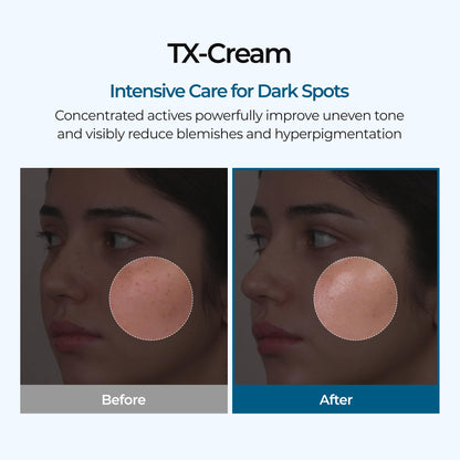DR.Melaxin TX Tranexamic Acid CREAM | Skin freckle Cream, Blemishes, Anti-pigmetation korean skin care - Maple Wellness Supplements