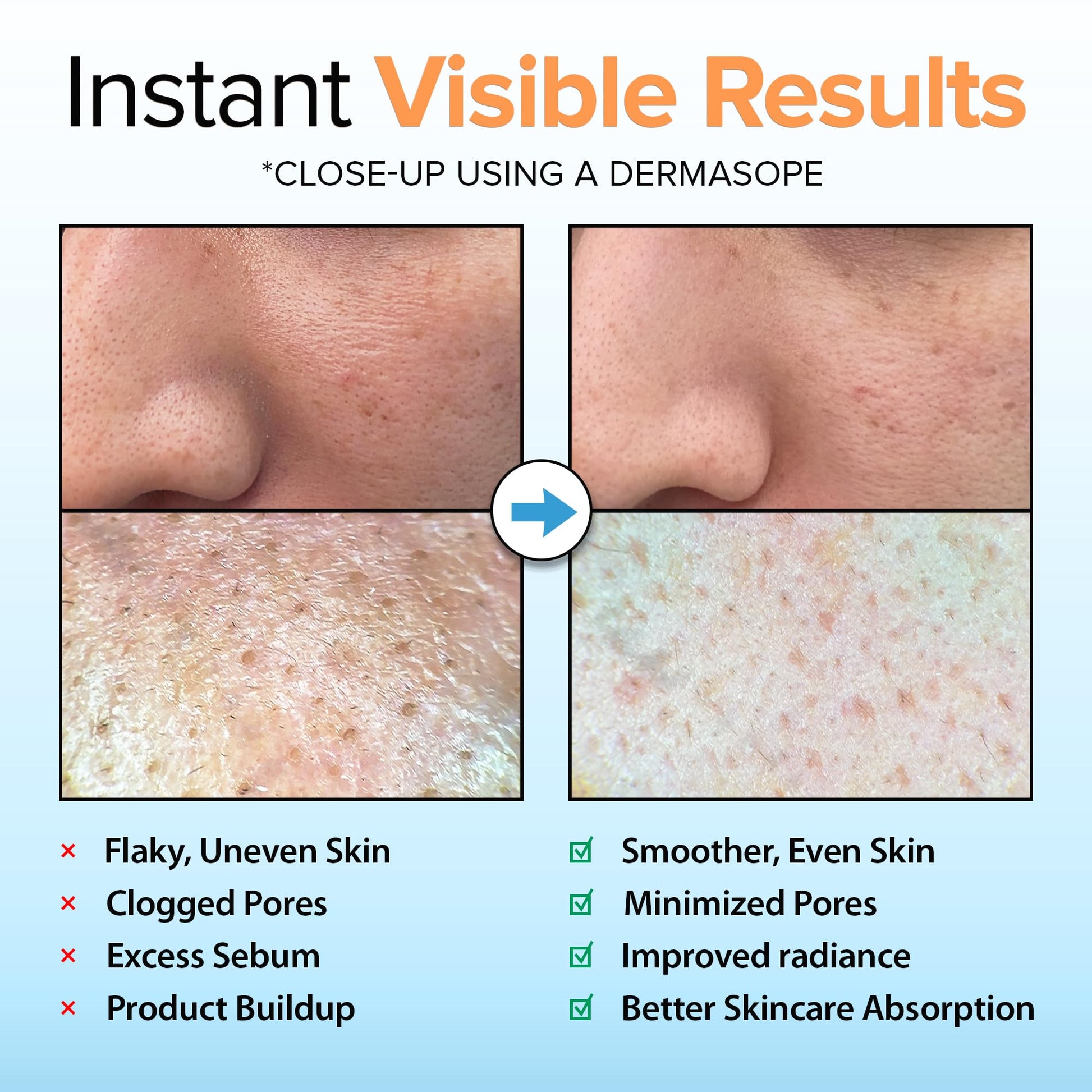Ebanel Brightening Peeling Gel with Cotton Cellulose, Rice, Papaya, Centella, Hyaluronic Acid for Face and Body, Gentle Exfoliating Face Scrub Gel Peel Wash, Deep Pore Cleanser Minimizer Exfoliator - Maple Wellness Supplements