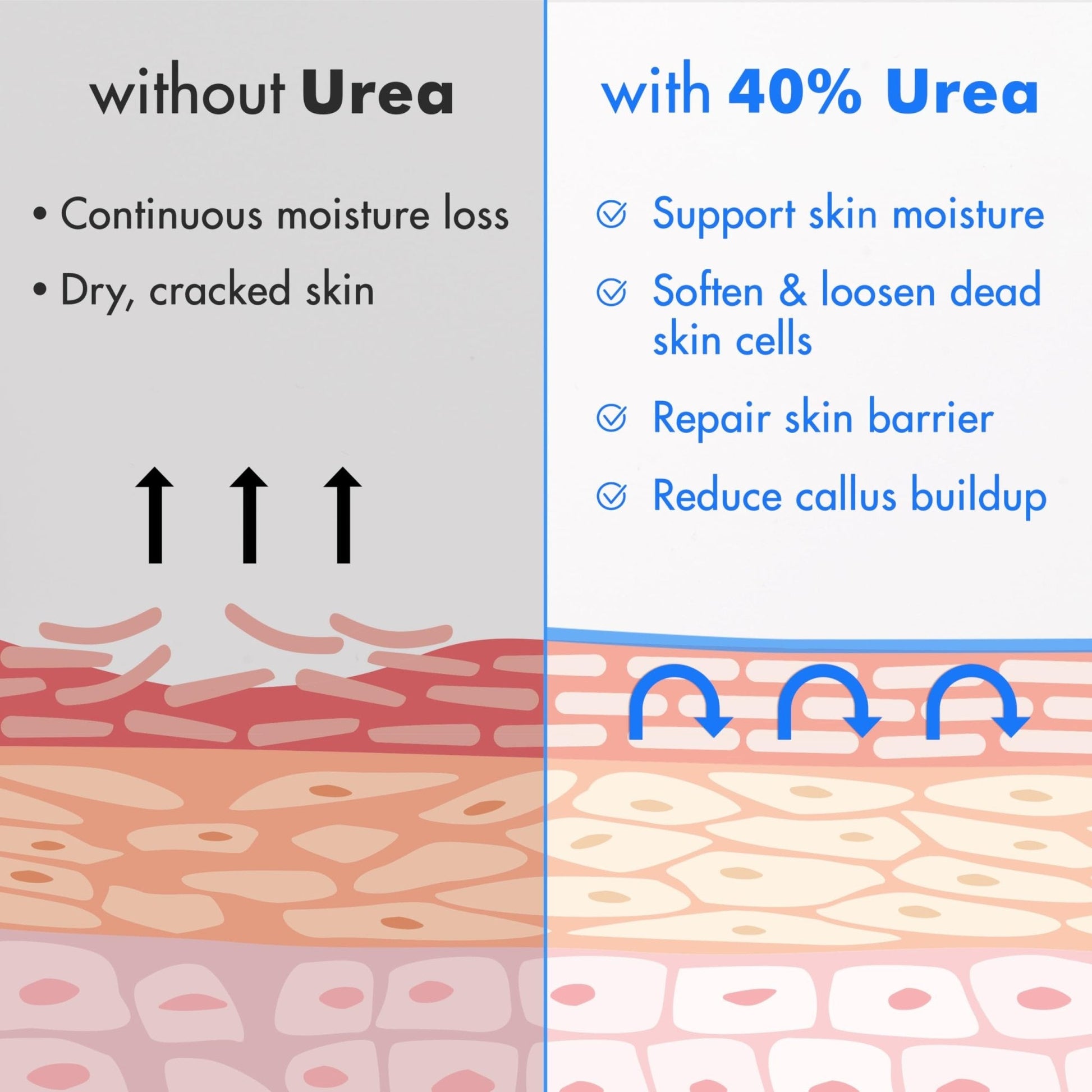 Ebanel Urea Cream 40% plus Salicylic Acid 2%, Foot Cream for Dry Cracked Heels Feet Knees Elbows Hands, Foot Dead Skin Cuticle Callus Remover Toenail Softener, Keratolytic Skin Barrier Repair - Maple Wellness Supplements