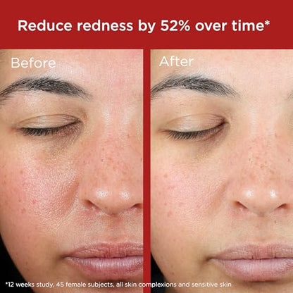 EltaMD UV Skin Recovery Green Tint 100% Mineral Sunscreen, SPF 50, Redness Correcting - Maple Wellness Supplements