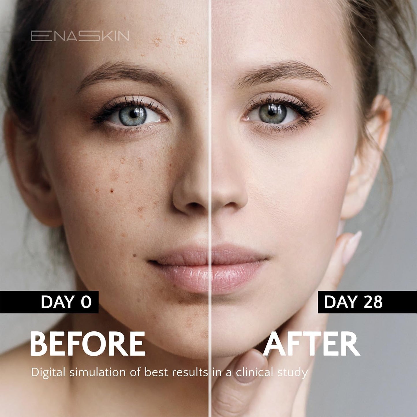 Enaskin Dark Spot Set - Serum & Soap Bars: Hyperpigmentation Body Treatment for Freckles Melasma Age Spot Sun Spot - Dark Spots Corrector Serum - Maple Wellness Supplements