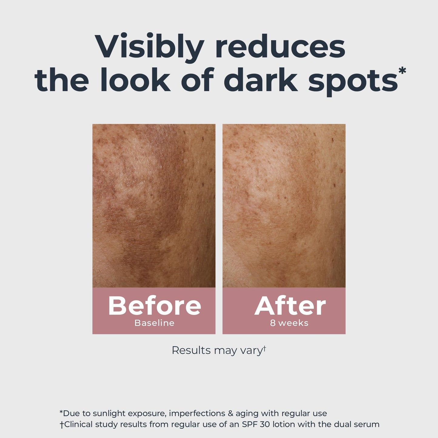 Eucerin Radiant Tone Dual Serum Dark Spot Corrector, Dark Spot Serum with Thiamidol - Maple Wellness Supplements