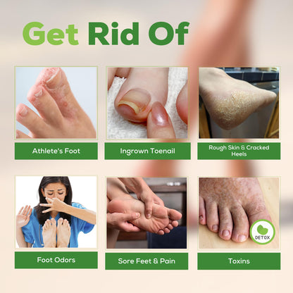 FOOT CURE Tea Tree Oil Foot Soak with Epsom Salt - Best Toenail Fungus Treatment, Athletes Foot & Softens Calluses - Soothes Sore & Tired Feet, Fungal Toe, Foot Odor Scent, Spa Pedicure (Pack of 2) - Maple Wellness Supplements