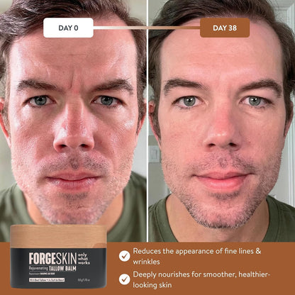 Forge Skin® Wrinkle Defense Beef Tallow Balm for Men [TALLOW-BASED] Moisturizer for Face Hydration - Hydrating Anti Aging Skin Cream - Maple Wellness Supplements
