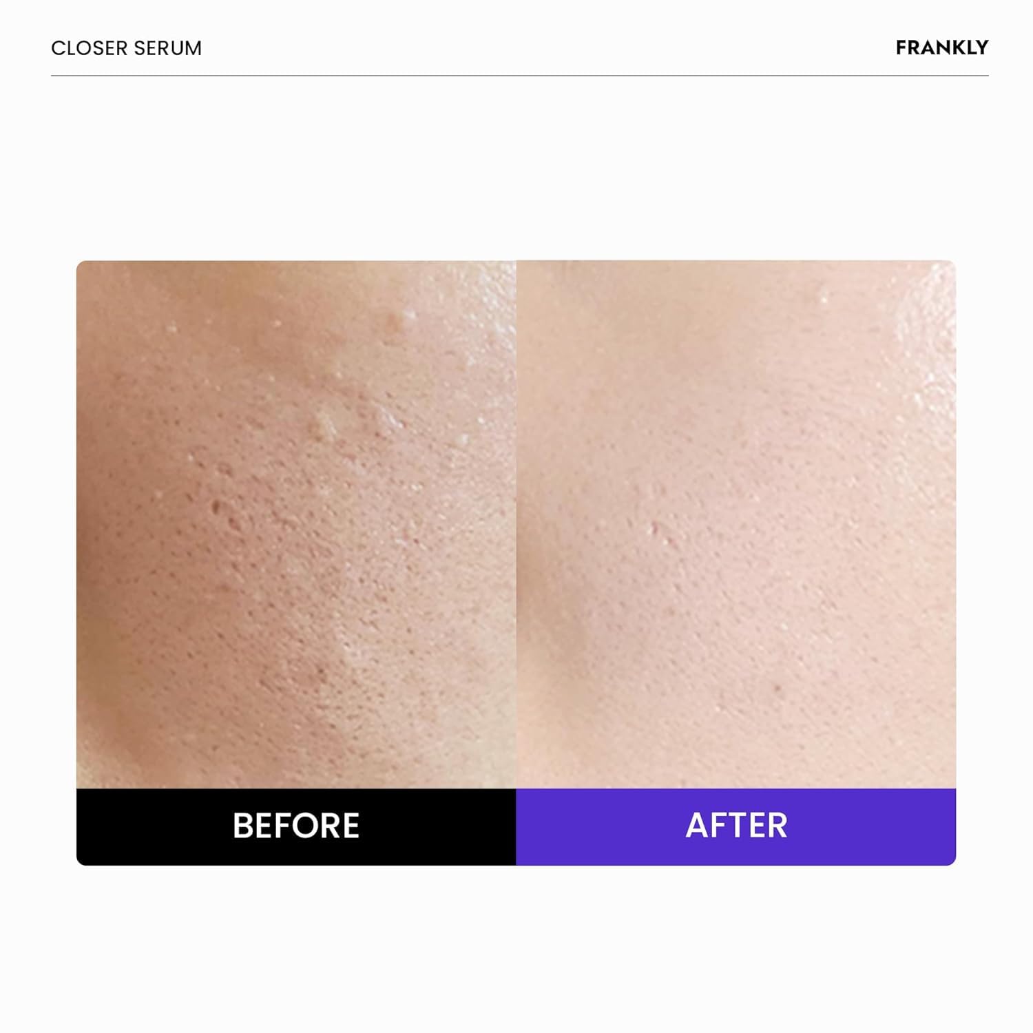 FRANKLY Closer Serum | Pore Minimizer Serum | 9 Peptides, Vegan Collagen, Adenosine, PHA | Korean Pore Minimizer for Glass Skin - Maple Wellness Supplements