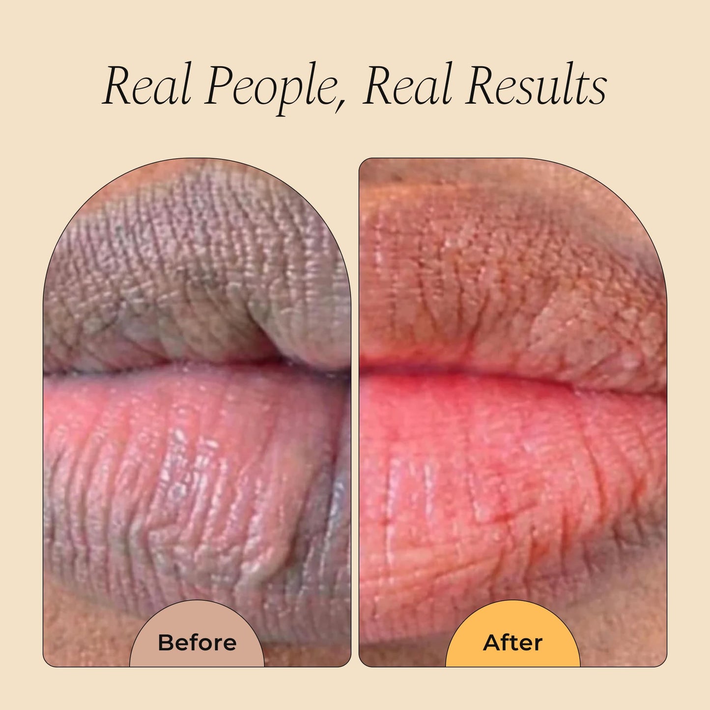 Glo Melanin All Natural Lemon and Turmeric Lip Balm - Natural Lip Balm Illuminate Your Smile - Maple Wellness Supplements