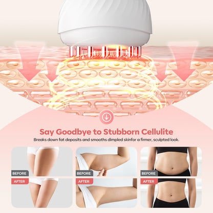 HarrFlow Lymphatic Drainage Massager & Anti Cellulite Massage Tool, Lymphatic Massager,Helps Reduce Stretch Marks & Cellulite，for Belly, Arms & Legs,Body Sculpting Machine with Heat & Vibration - Maple Wellness Supplements