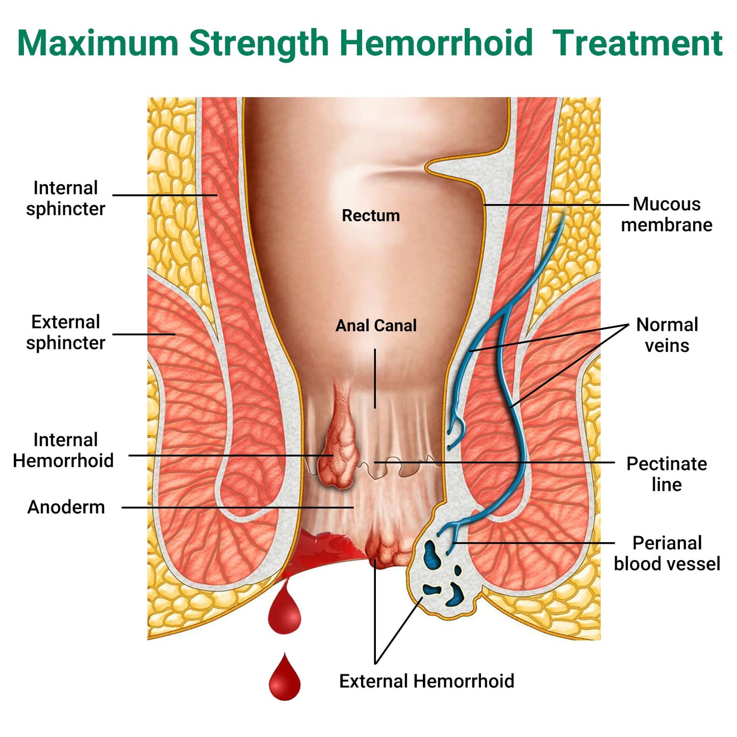 Hemorrhoid Treatment Ointment, Maximum Strength Treatment & Fast Relief for Pain, Itching, Burning, Swelling, Fissure, Bleeding, Discomfort, Long-Lasting Internal & External Hemorrhoid Cream, (2-Pack) - Maple Wellness Supplements