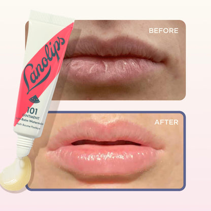 Lanolin 101 Multipurpose Ointment - Lanolin Lip Balm & Healing Ointment for Skin Barrier Repair - Moisturizer for Dry Lips, Cuticles & Elbows - No Petroleum Formula - Watermelon (0.35 oz) - Maple Wellness Supplements