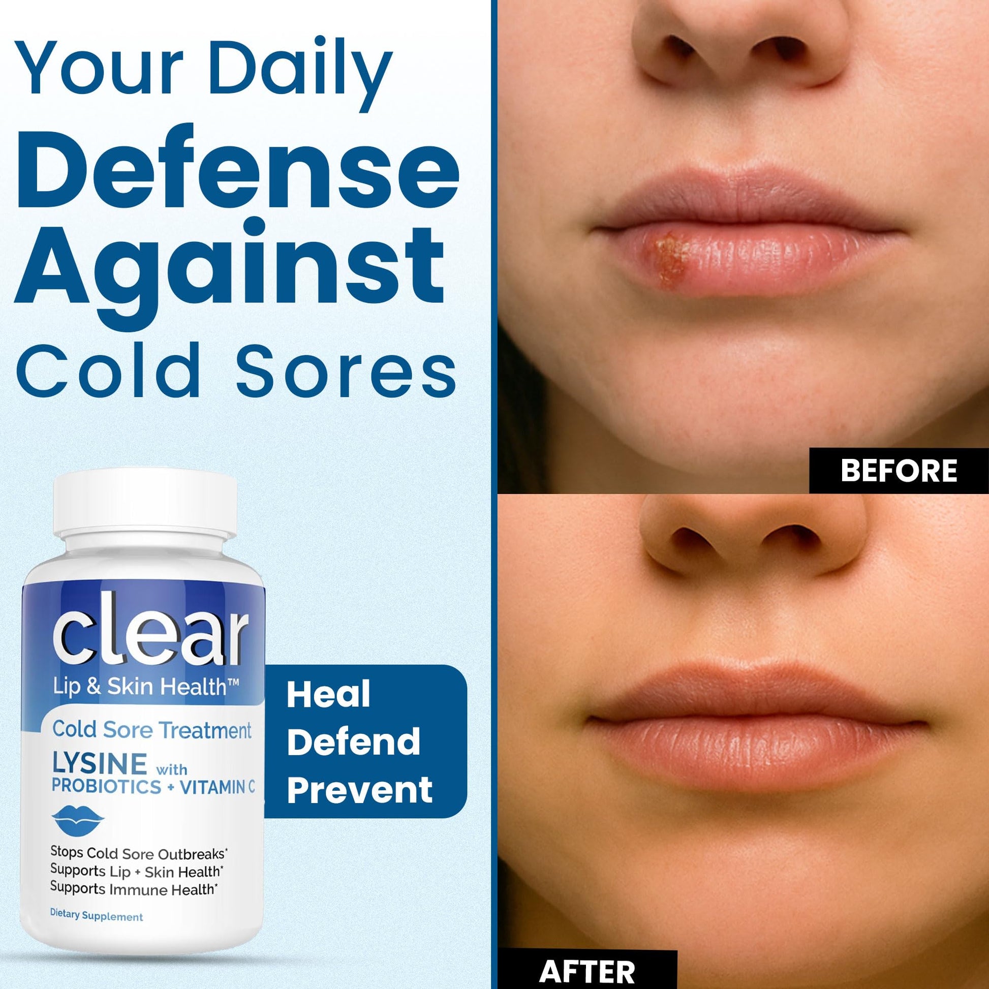 Lysine Cold Sore Treatment for Lips with Pre-Probiotics & VIT C | 1 Month Supply | Supercharged Lysine Capsules with Rhamnosus & Acidophilus for Cold Sores Relief - Maple Wellness Supplements