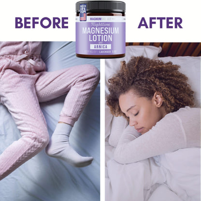 Magnum Solace Nighttime Magnesium Lotion with Arnica – Highly Concentrated Magnesium - Maple Wellness Supplements