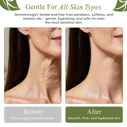 M.D. Blend Crepe-Ease Body Moisturizer Anti Aging Retinol Cream Firming, Smoothing & Hydrating Cream for Crepey Skin on Neck, Arms & Legs Crepe Skin Repair, Advanced Crepe Fix, 4 oz - Maple Wellness Supplements