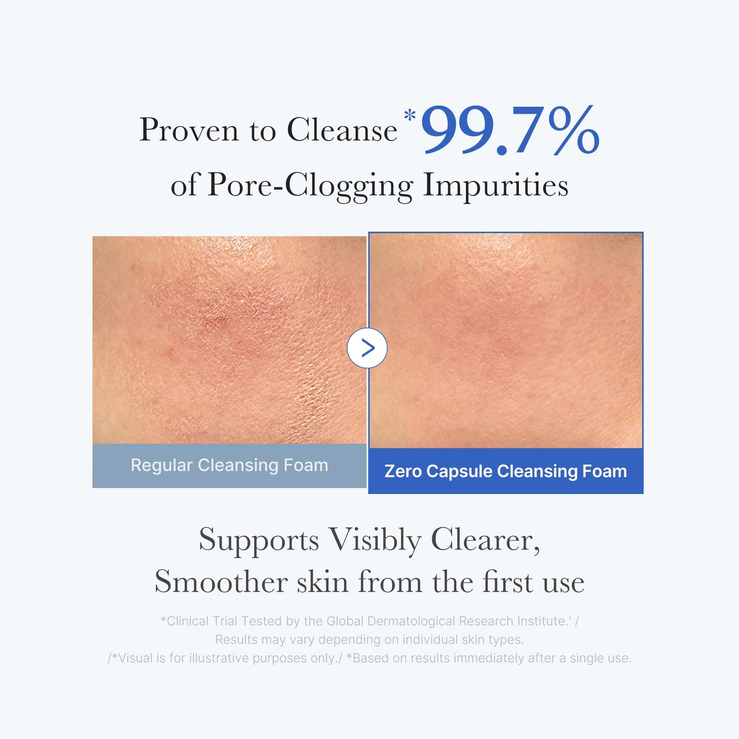 medicube Facial Cleanser Zero Pore Capsule Cleansing Foam | Daily Gentle Cleanser for Skin Texture, Blackhead & Pore Care - Maple Wellness Supplements