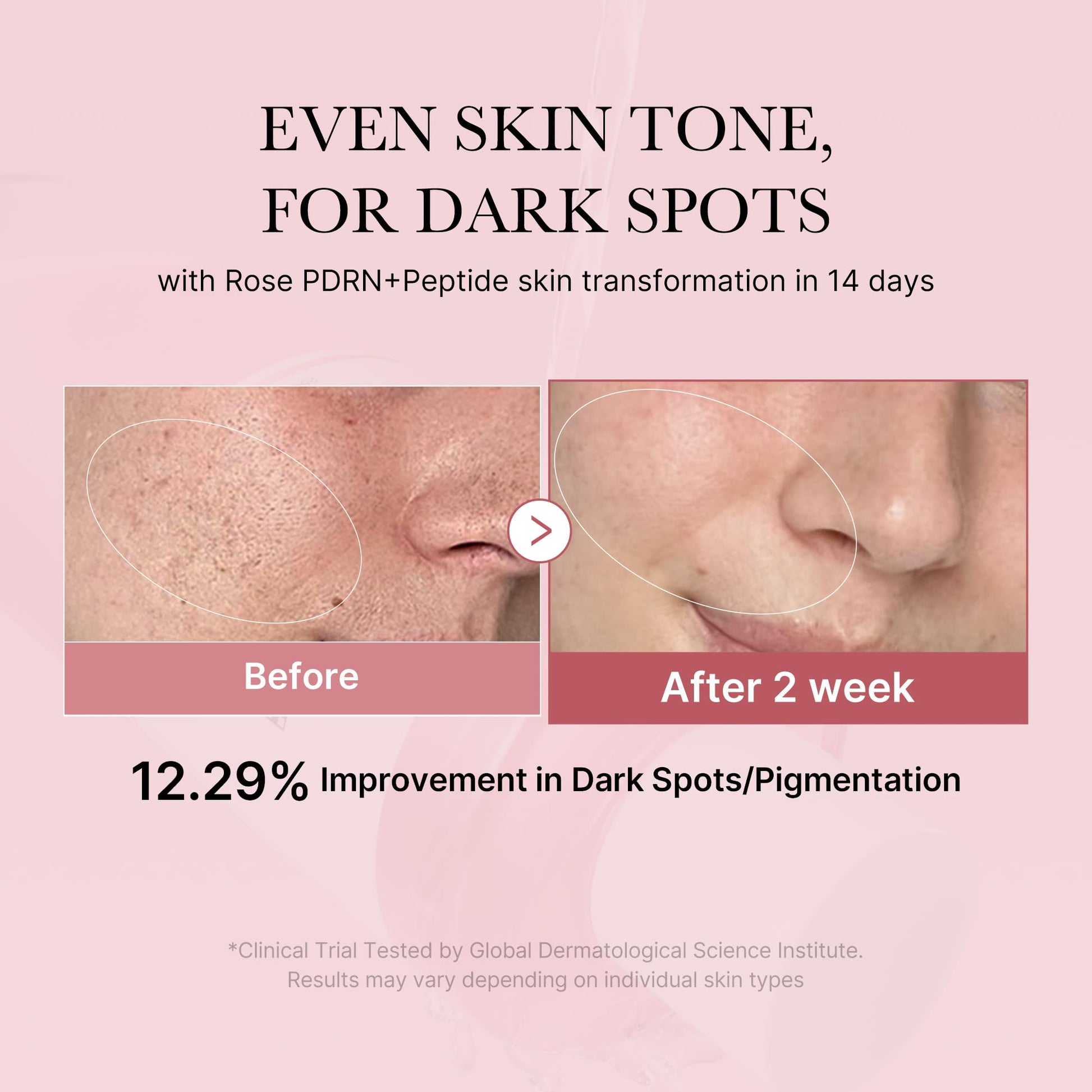 medicube PDRN Toner Rose PDRN Peptide Toner | Lightweight & Watery Type for Skin Boosting, Soothing and Calming, Uneven Skin Tone | with Rose, Peptide, Niacinamide | Korean Skincare, 8.45 fl.oz - Maple Wellness Supplements