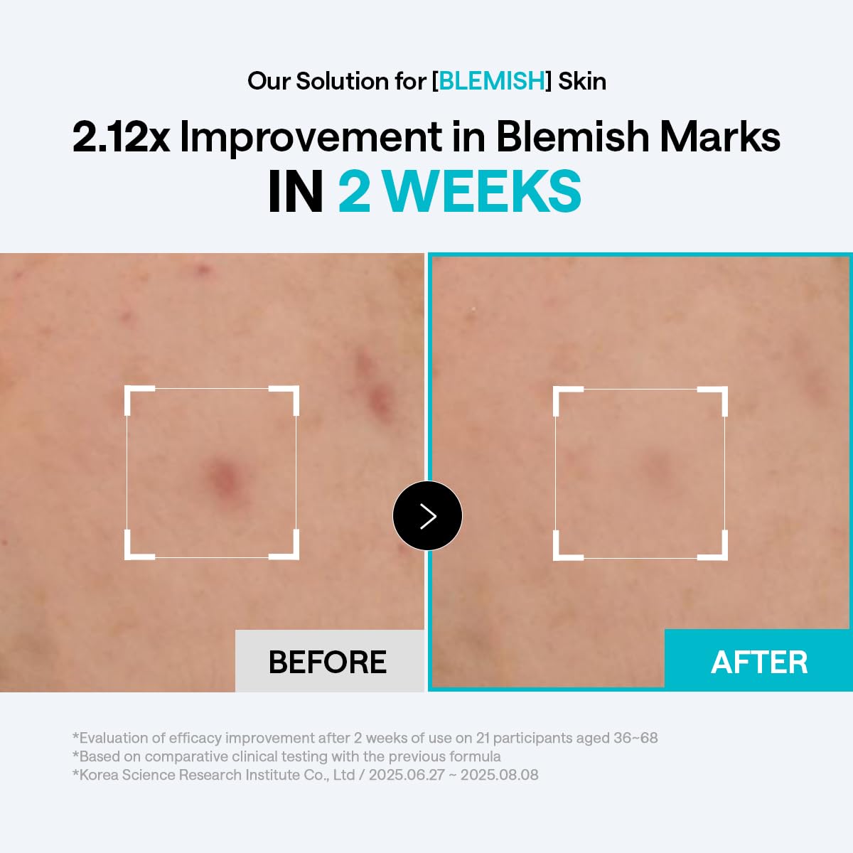 MEDIHEAL Toner Pads 100 Count - Madecassoside Blemish Care Toner Pad with Centella Asiatica - Improves Uneven Skin Tone & Deep Hydration - Maple Wellness Supplements