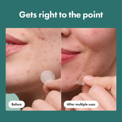 Mighty Patch Micropoint Large Hydrocolloid Pimple Patches for Face Blemishes from Hero Cosmetics, Acne Stickers for Early Stage Zits - Maple Wellness Supplements