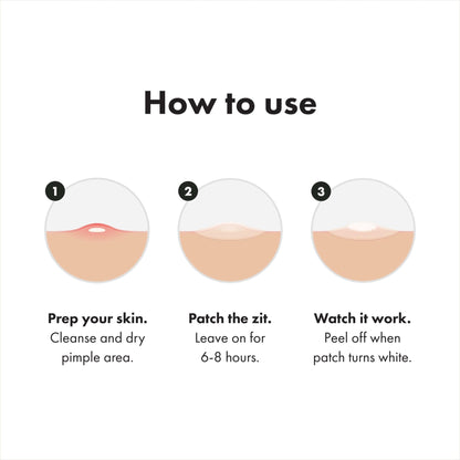 Mighty Patch™ Variety Pack from Hero Cosmetics - Hydrocolloid Acne Pimple Patches for Covering Zits and Blemishes - Maple Wellness Supplements