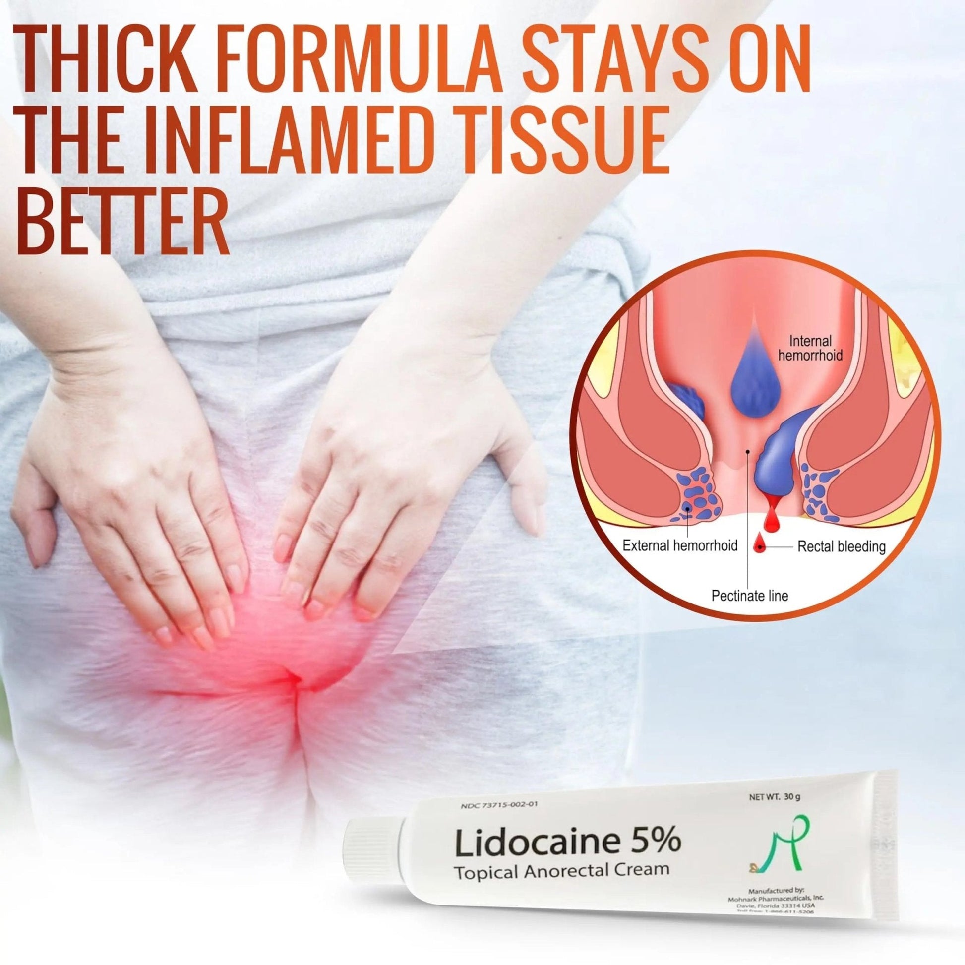 Mohnark Maximum Strength Lidocaine Hemorrhoid Treatment Cream for External and Internal Hemorrhoids Treatment Burn Itch Pain Relief Anal Cream Topical Anorectal Numbing Cream- 30 Gram Tube Made in USA - Maple Wellness Supplements