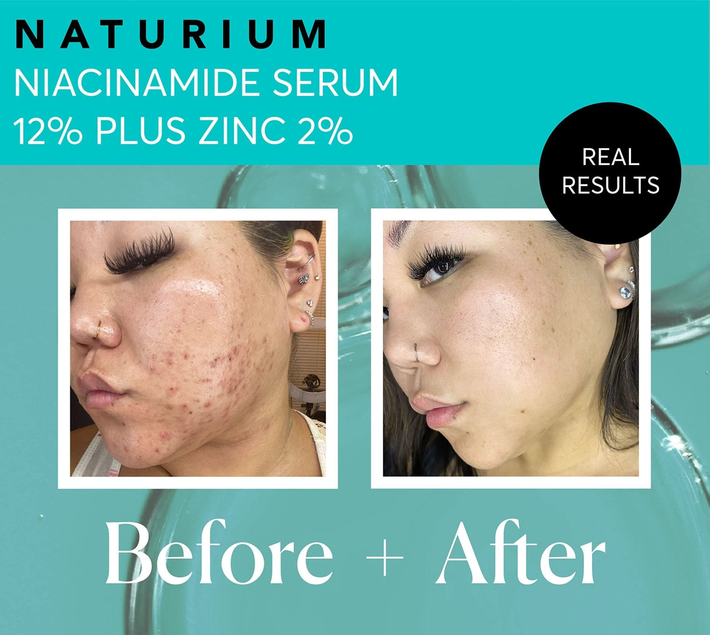 Naturium Niacinamide Face Serum 12% Plus Zinc 2%, Anti-Aging, Pore Minimizer & Dark Spot Corrector - Maple Wellness Supplements