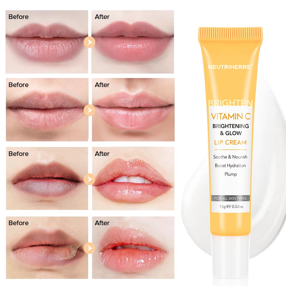 NEUTRIHERBS Lip Cream, Vitamin C Lip Balm to Nourish and Soothes Dry, Cracked Lips - Maple Wellness Supplements