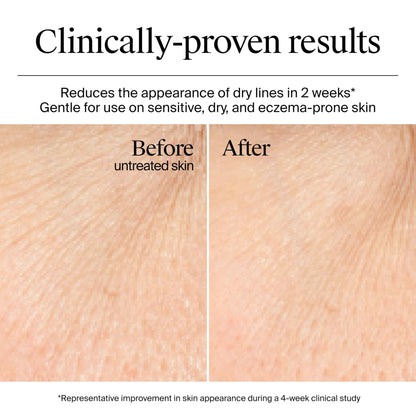 Neutrogena Hydro Boost Gel Cream, 48 Hr Hydration for Normal/Dry Skin, Fragrance Free - Maple Wellness Supplements