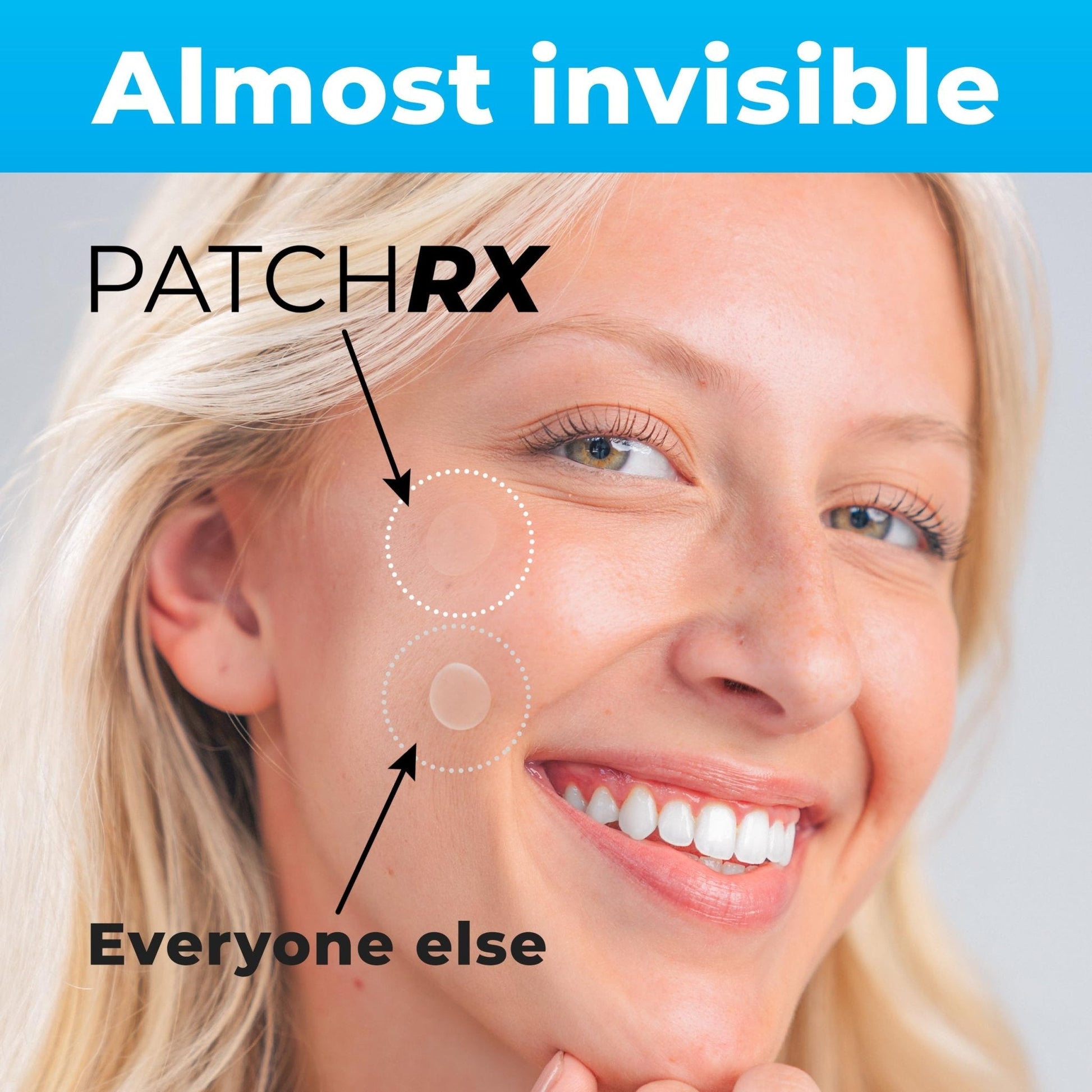 PatchRx Pimple Patches for Face (120 Patches), Hydrocolloid Acne Patches with Tea Tree Oil - Maple Wellness Supplements