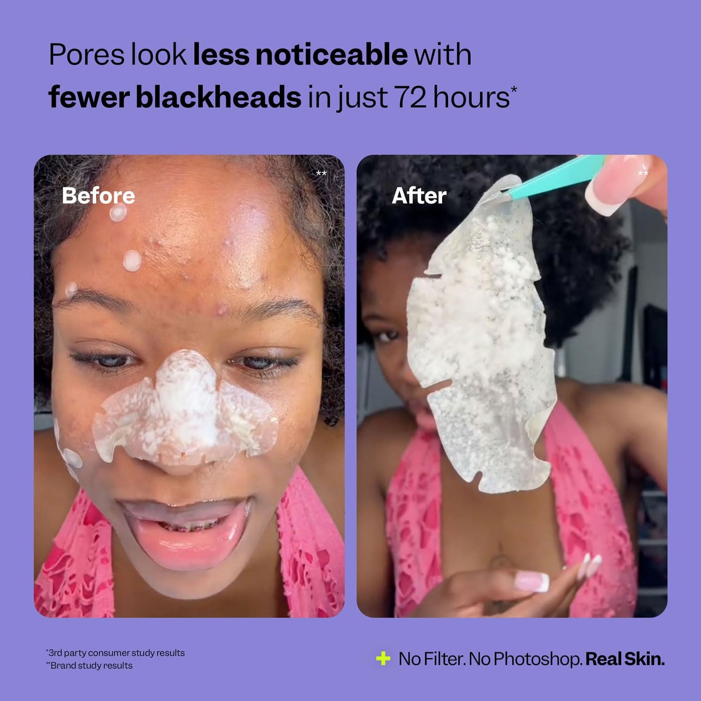 Peach Slices - Nose Pore Patches (7 ct) - Overnight Blackhead Remover - Pore Strips - Absorbs Gunk - Thin, Flexible & Painless - Hydrocolloid Patches - Maple Wellness Supplements