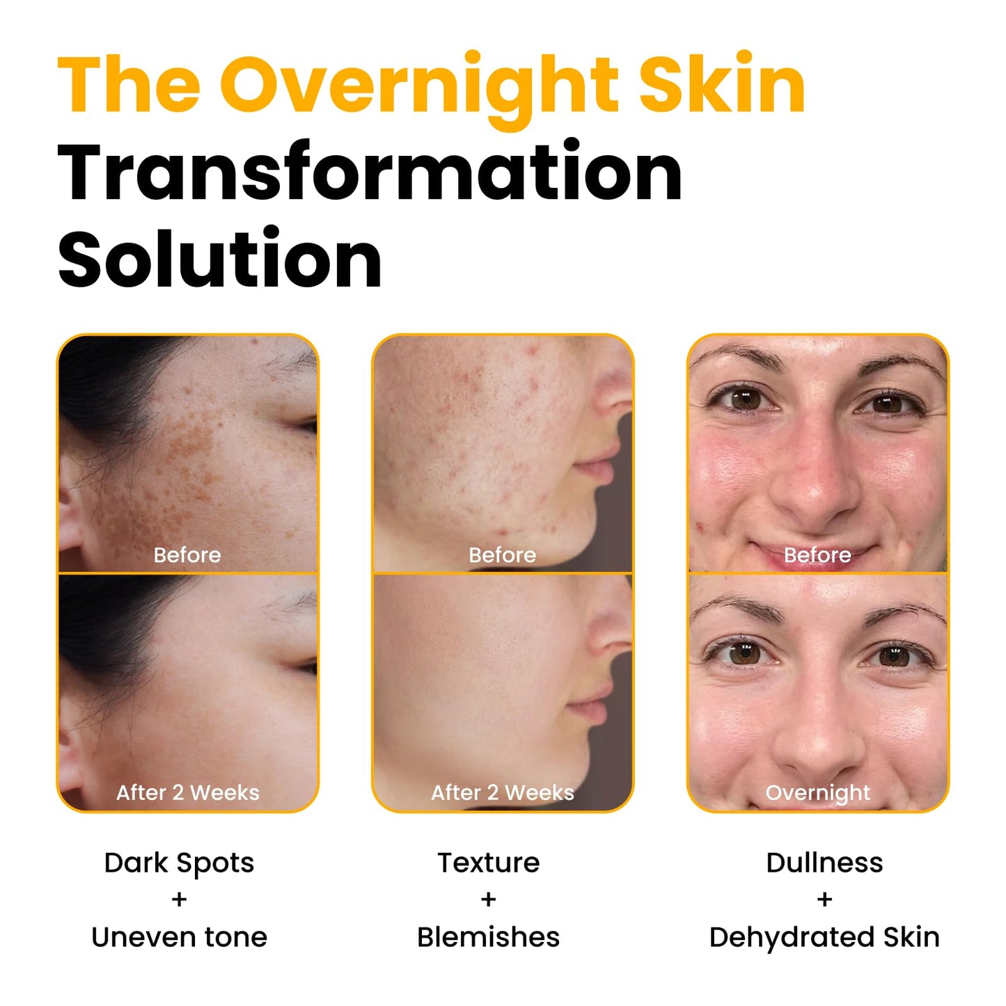 QUIA Turmeric + Kojic Acid Overnight Wrapping Mask – Hydration Mask for Glowing Skin - Maple Wellness Supplements