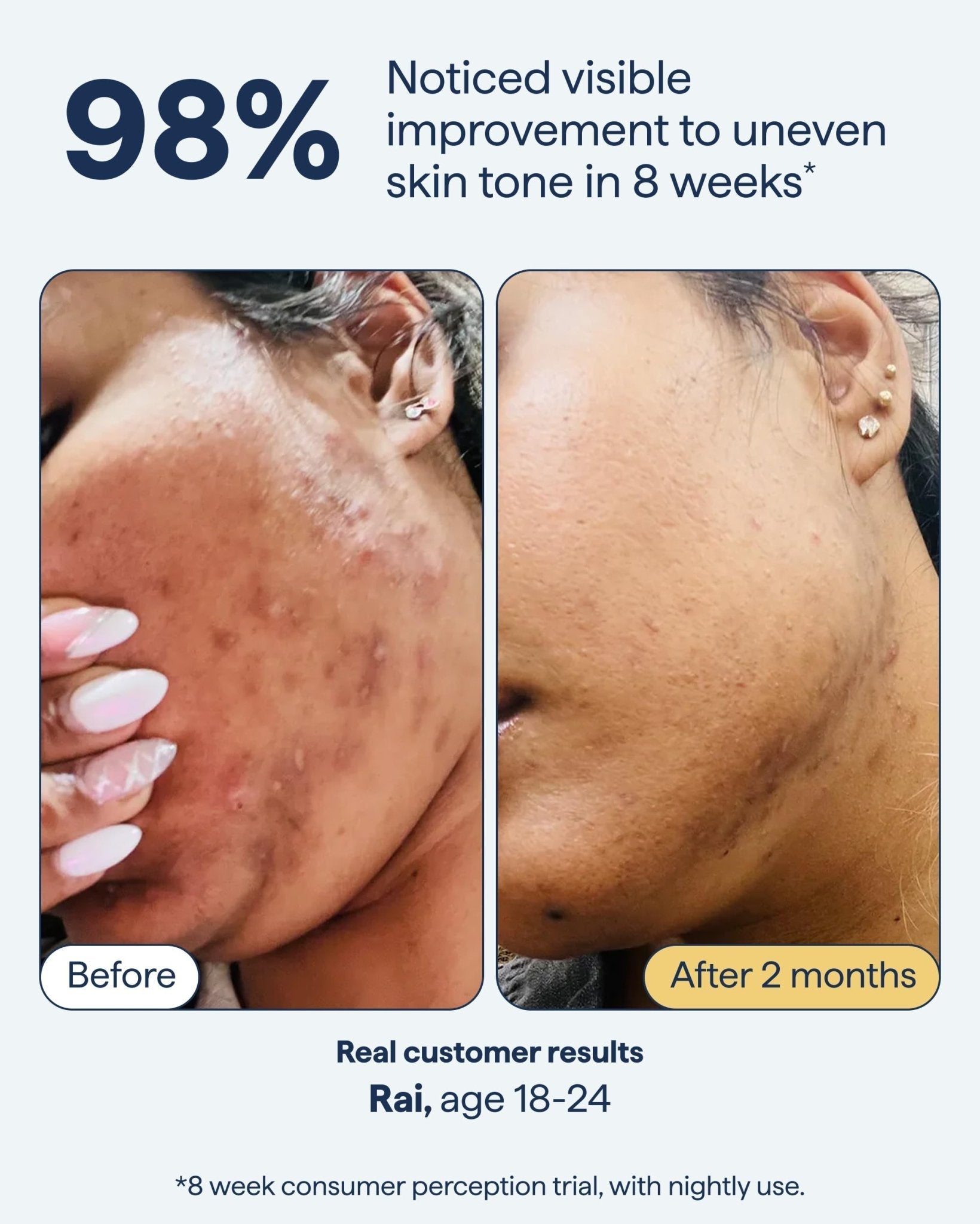 Remedy for Dark Spots | Advanced Night Treatment with Retinol & Kojic Acid | For Discoloration and Uneven Tones | With Glutathione - Maple Wellness Supplements
