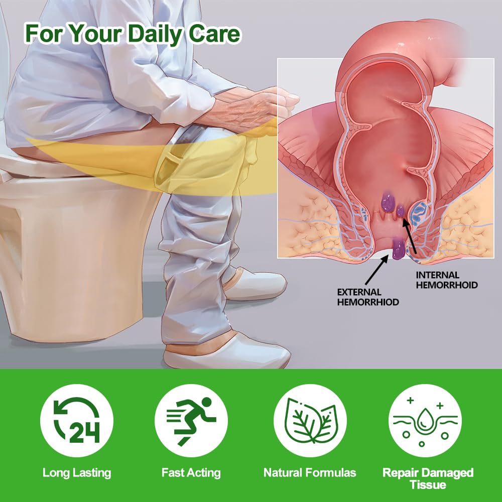 RHAICARE Hemorrhoid and Fissure Cream,Hemorrhoidal Ointment for Fast Acting Itch, Swelling, and Maximum Strength Pain Relief（1 Pack - Maple Wellness Supplements
