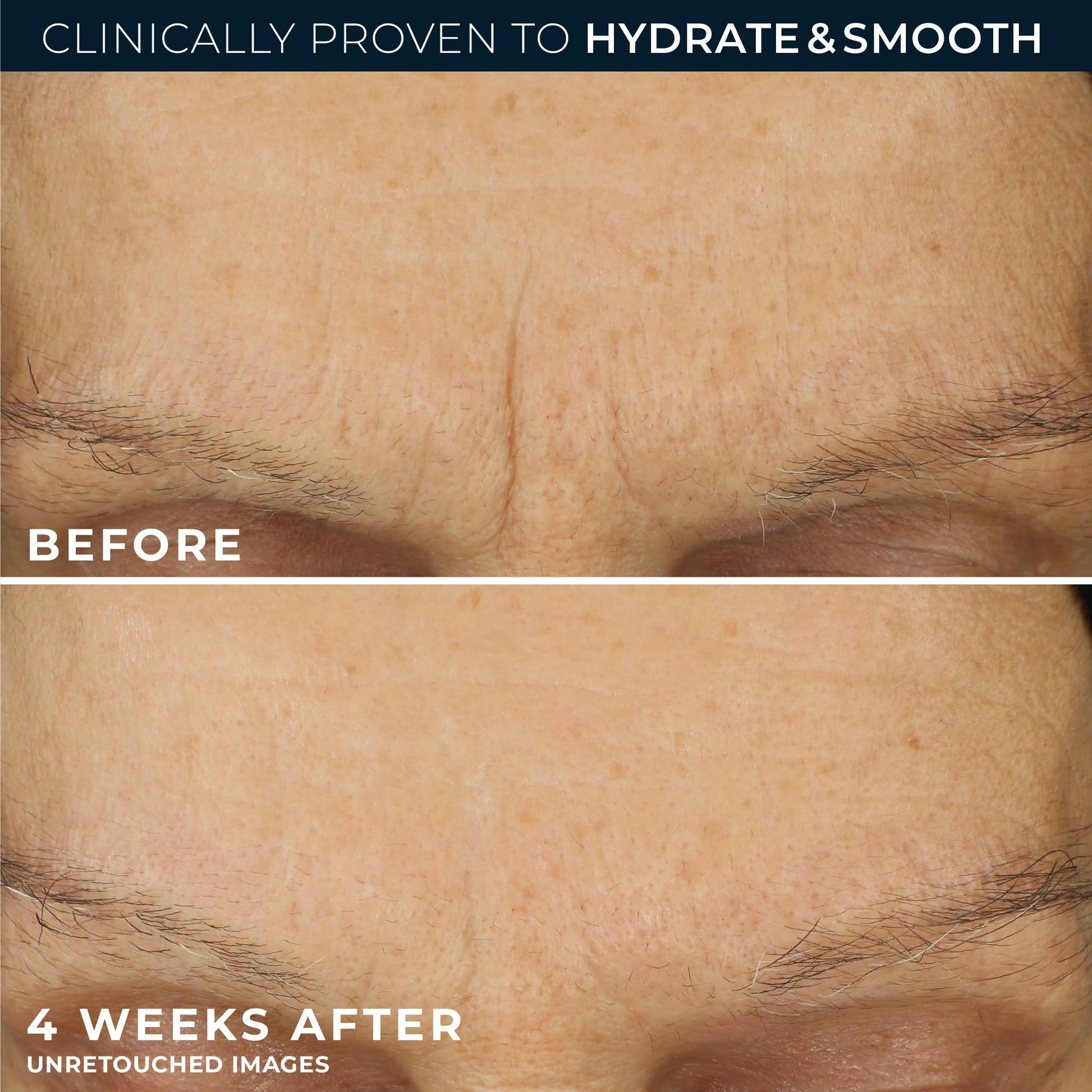 RoC Retinol Correxion Max Daily Hydration Anti-Aging Face Moisturizer with Hyaluronic Acid - Maple Wellness Supplements