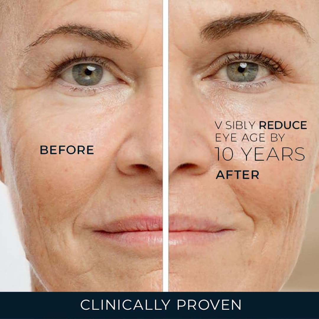 RoC Retinol Correxion Under Eye Cream for Dark Circles & Puffiness, Daily Wrinkle Cream - Maple Wellness Supplements