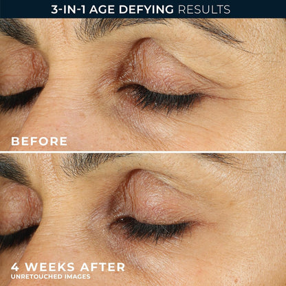 RoC Retinol Correxion Under Eye Cream for Dark Circles & Puffiness, Daily Wrinkle Cream - Maple Wellness Supplements