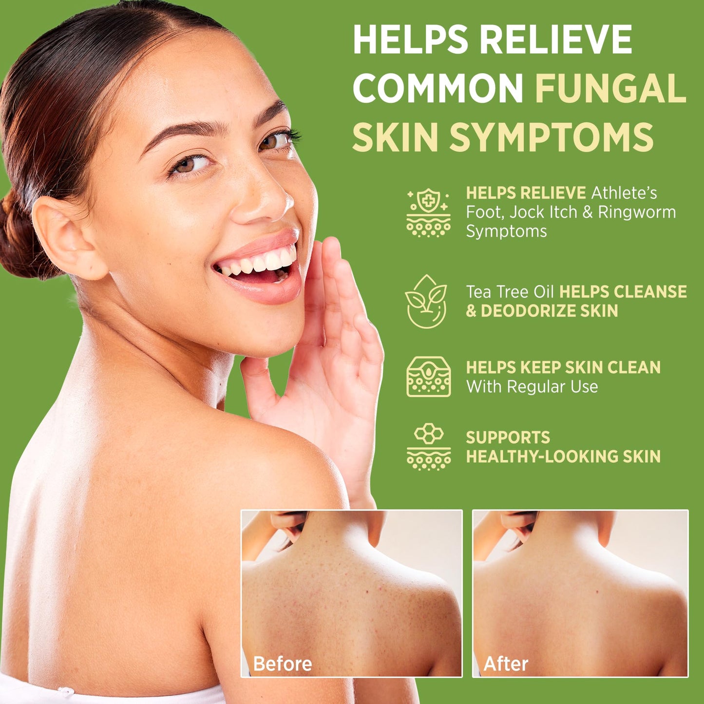 Roycederm Antifungal Bar Soap - Tea tree Oil Soap - Athlete’s Foot Treatment for Jock Itch & Ringworm - Maple Wellness Supplements