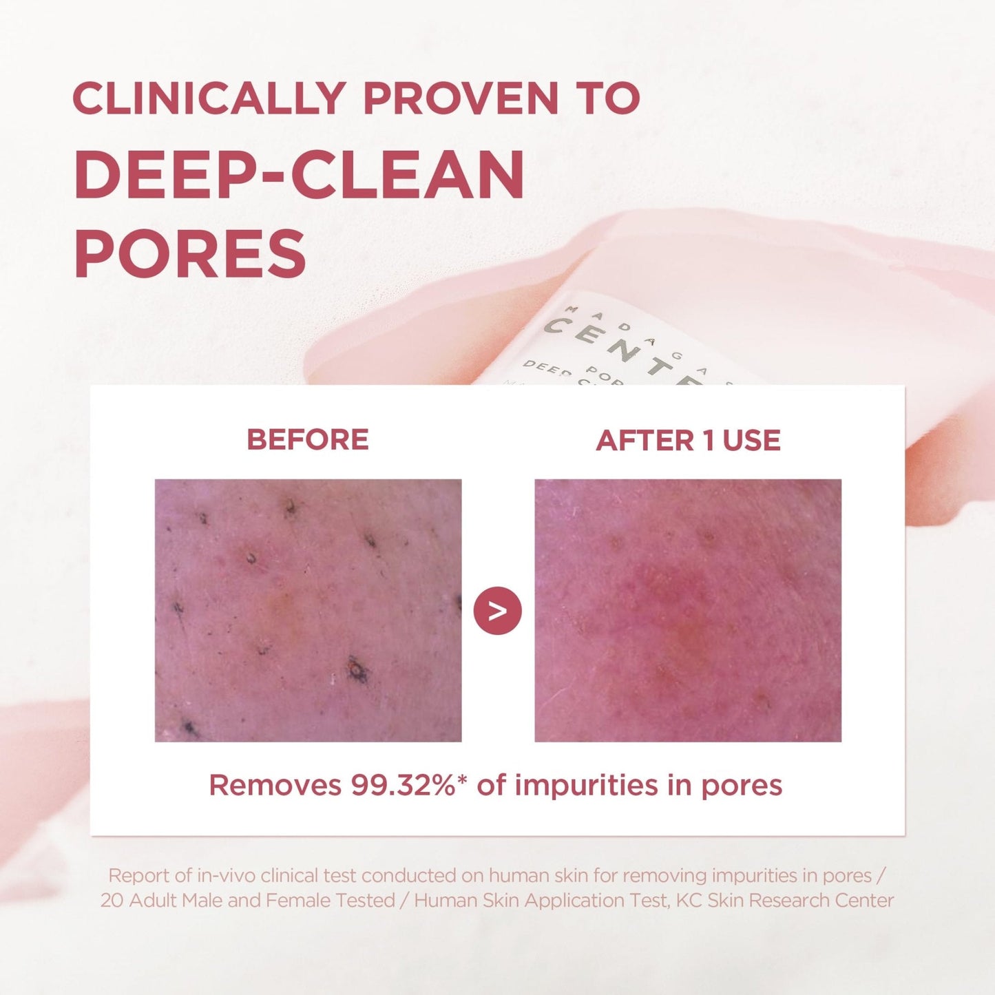 SKIN1004 Poremizing Deep Cleansing Foam, 4.23 fl.oz, 125ml, Makeup Remover, Korean Face Cleanser with Himalayan Pink Salt - Maple Wellness Supplements