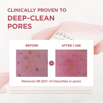 SKIN1004 Poremizing Deep Cleansing Foam, 4.23 fl.oz, 125ml, Makeup Remover, Korean Face Cleanser with Himalayan Pink Salt - Maple Wellness Supplements