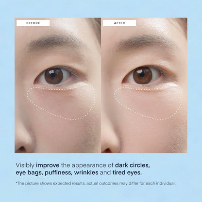 Terez & Honor Under Eye Patches for Dark Circles - 60 Korean Hydrogel Masks for Puffiness - Maple Wellness Supplements