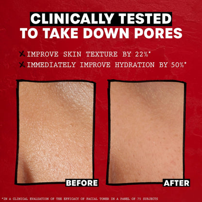 THAYERS Alcohol-Free Rose Petal Witch Hazel Facial Toner for Glowing Skin, Soothing - Maple Wellness Supplements