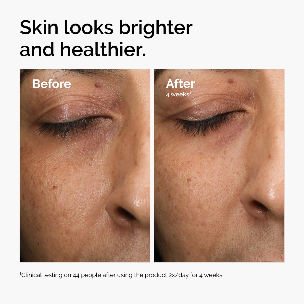 The Ordinary Multi-Antioxidant Radiance Serum, Vitamin C Serum For Face, Brighten & Protect Skin – Boosts Glow - Maple Wellness Supplements