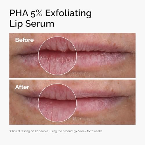 The Ordinary PHA 5% Exfoliating Lip Serum, Hydrating Overnight Lip Exfoliator Treatment, 0.5 Fl Oz - Maple Wellness Supplements