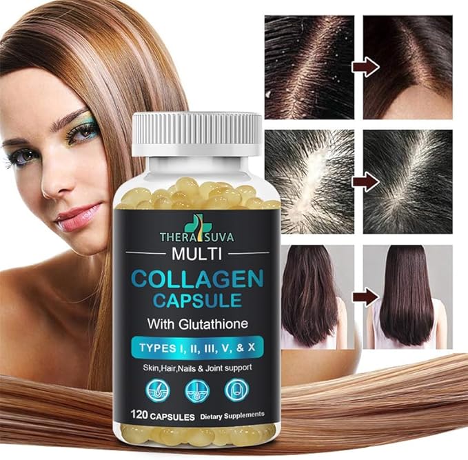 TheraSuva Complete Multi Collagen Complex – Types I, II, III, V & X + Biotin & Vitamin C – Hair, Skin, Nails & Joint Support, 2 Month Supply, 120 Softgels - Maple Wellness Supplements