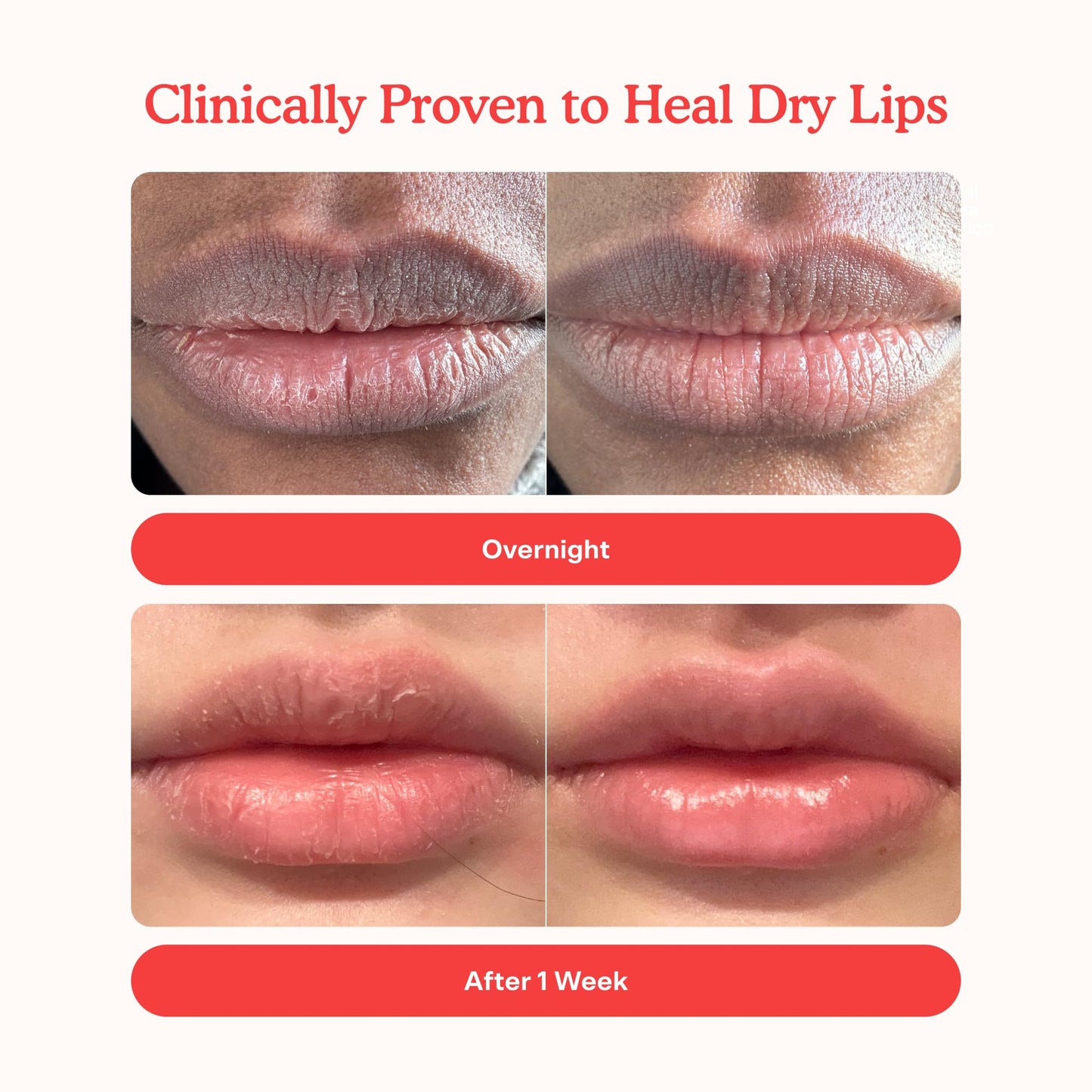 Tower 28 LipSoftie Tinted Lip Balm Treatment - Hydrating Glossy Balm + Overnight Lip Mask with Jojoba Oil + Shea Butter - Sweet - Maple Wellness Supplements