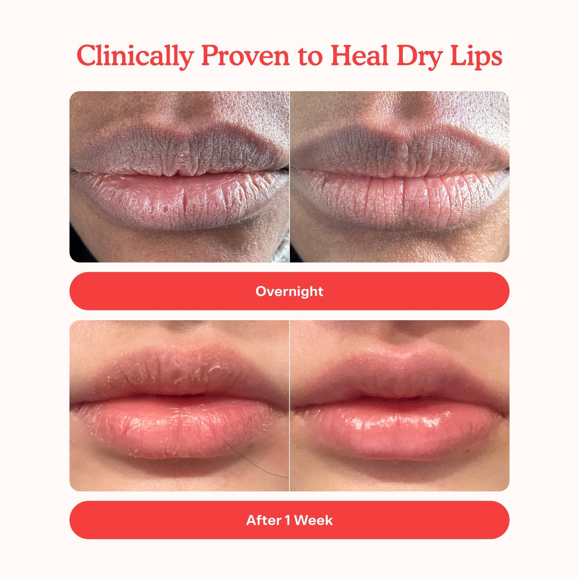 Tower 28 LipSoftie Tinted Lip Balm Treatment - Hydrating Glossy Balm + Overnight Lip Mask with Jojoba Oil + Shea Butter - Sweet - Maple Wellness Supplements